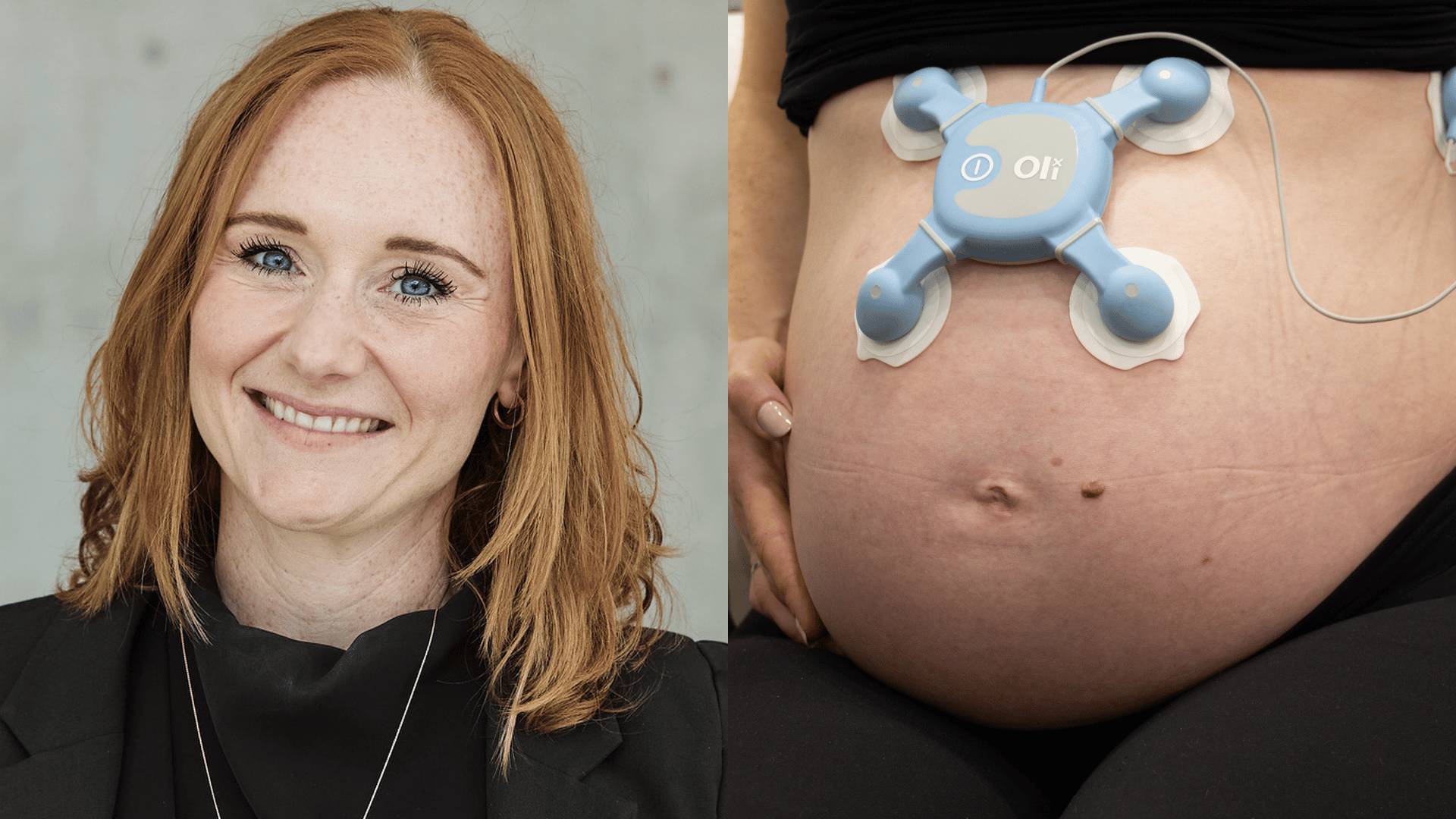 Medtech startup Oli raises $6.5 million to predict birth complications before they happen